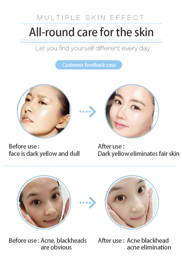 Newest Oxygene Jet Peel Hydrodermabrasion Facial Machine Skincare Oxygenated Facial Machine with Led Facial Masks