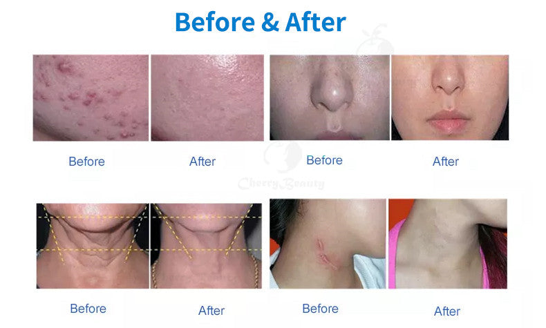 New 6 In 1 Facial Skin Whitening Rejuvenation Tightening Care 7 Colors Pdt Led Photon Light Therapy Machine for sale