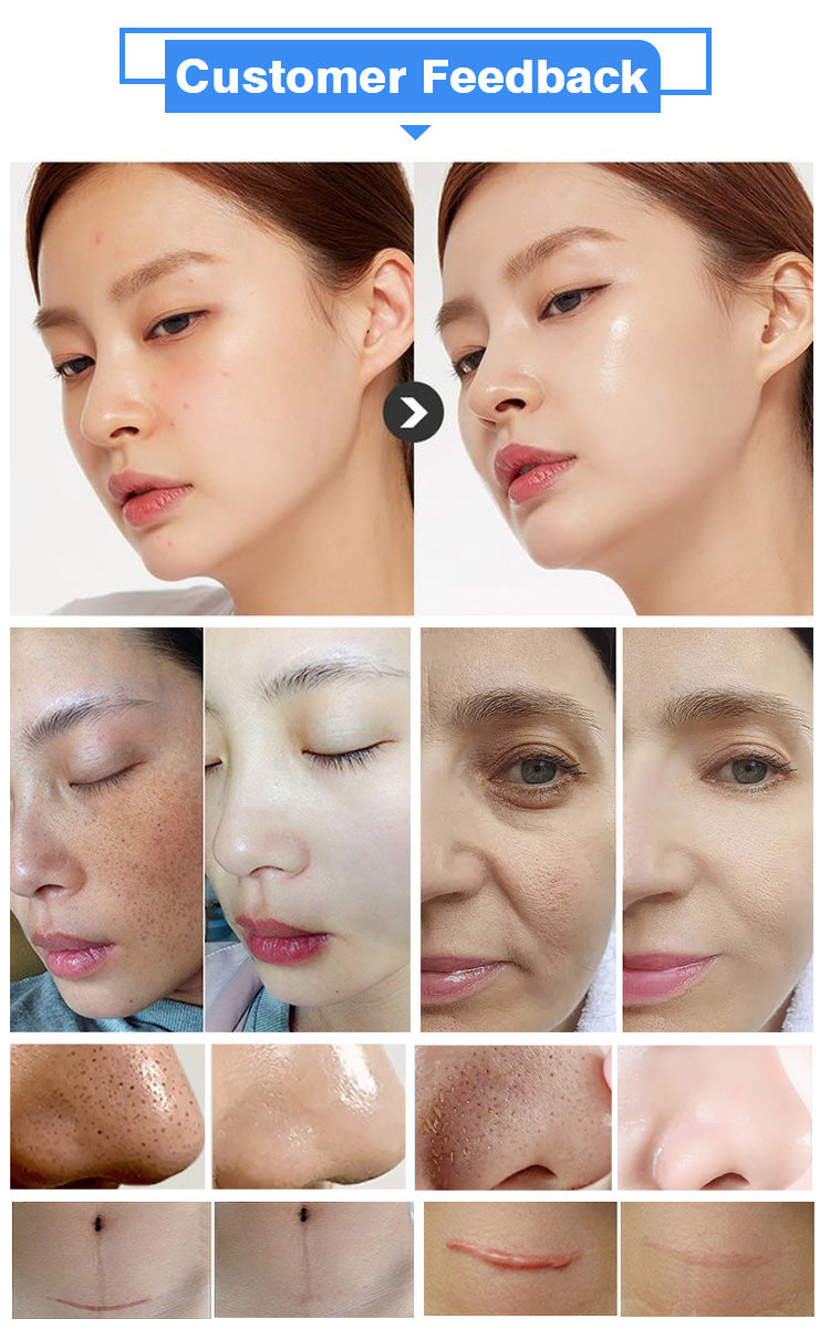 11 In 1 Facial Peeling Hydra dermabrasion Skin Care Beauty Machine