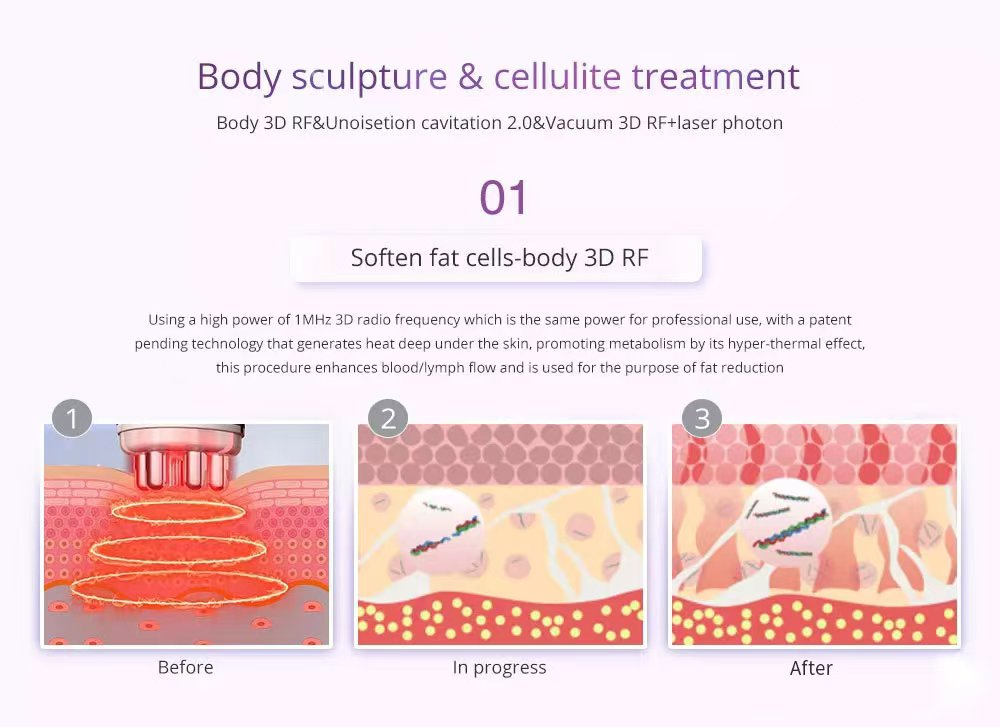 Factory price 8 IN 1 Lipolaser Rf Ultrasonic 40K Vacuum Cavitation System Slimming Beauty Machine