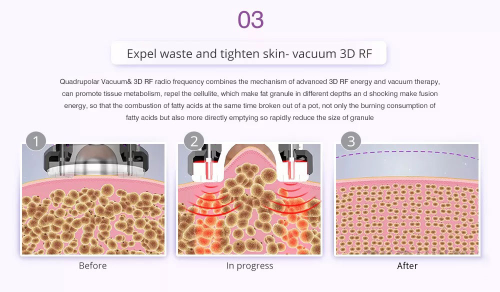 Factory price 8 IN 1 Lipolaser Rf Ultrasonic 40K Vacuum Cavitation System Slimming Beauty Machine
