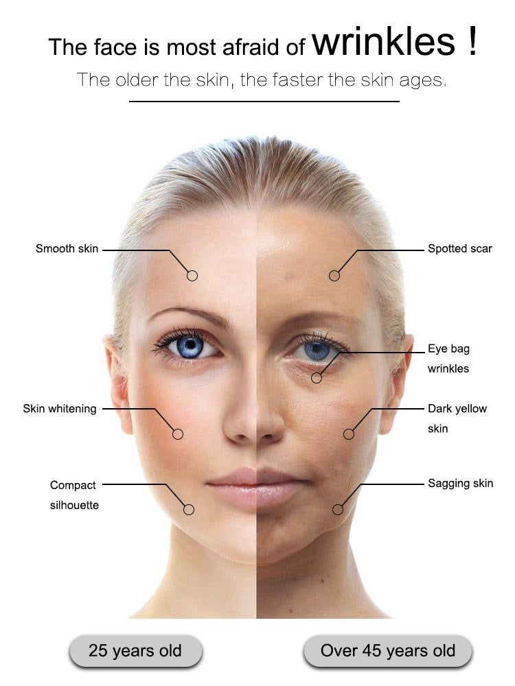 Hifu 2D Anti-wrinkle skin Tightening Face Lifting Device