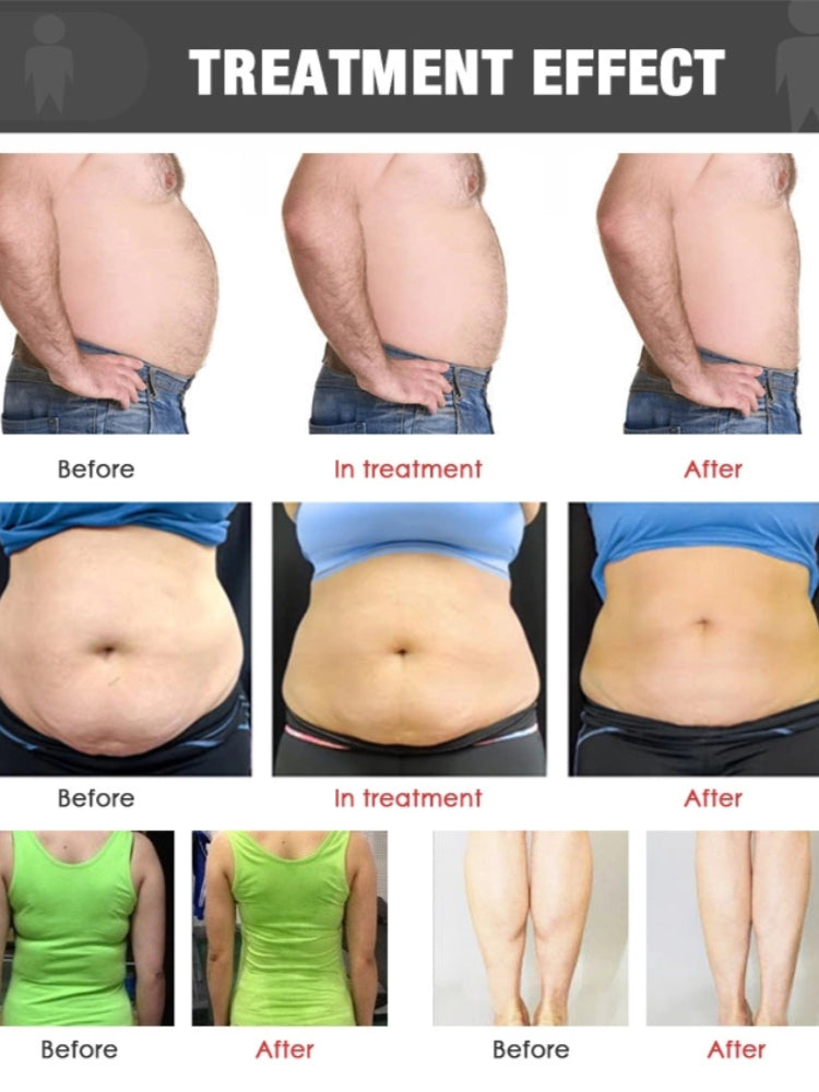 Velashape X8 body contouring slimming machine
