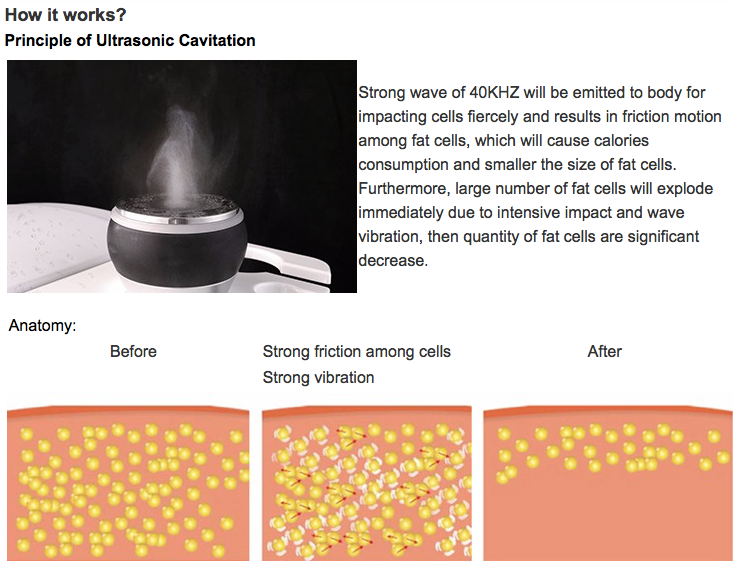 40k Cavitation Ultrasound RF lifting Slimming Machine
