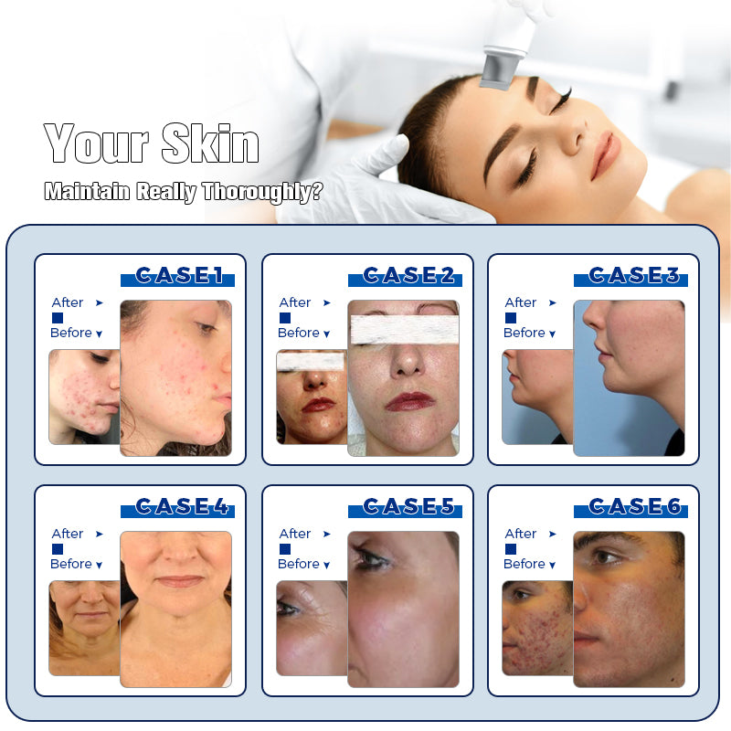 Multifunctional 14 in1 Professional Hydrafacial Beauty Machine SPA