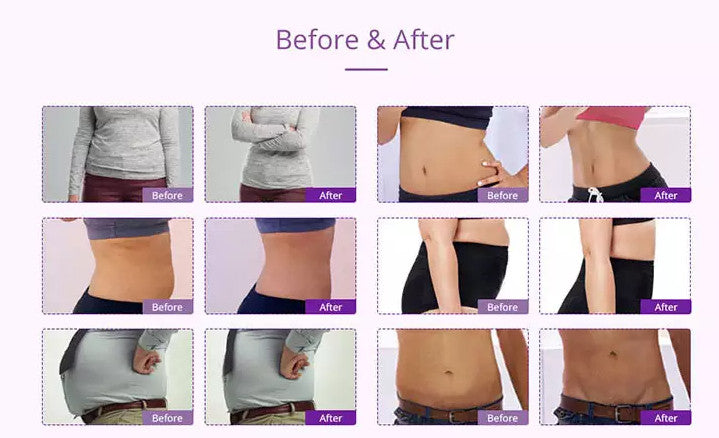 40k Cavitation Ultrasound RF lifting Slimming Machine