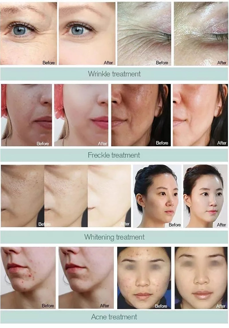 Multifunctional 14 in1 Professional Hydrafacial Beauty Machine SPA