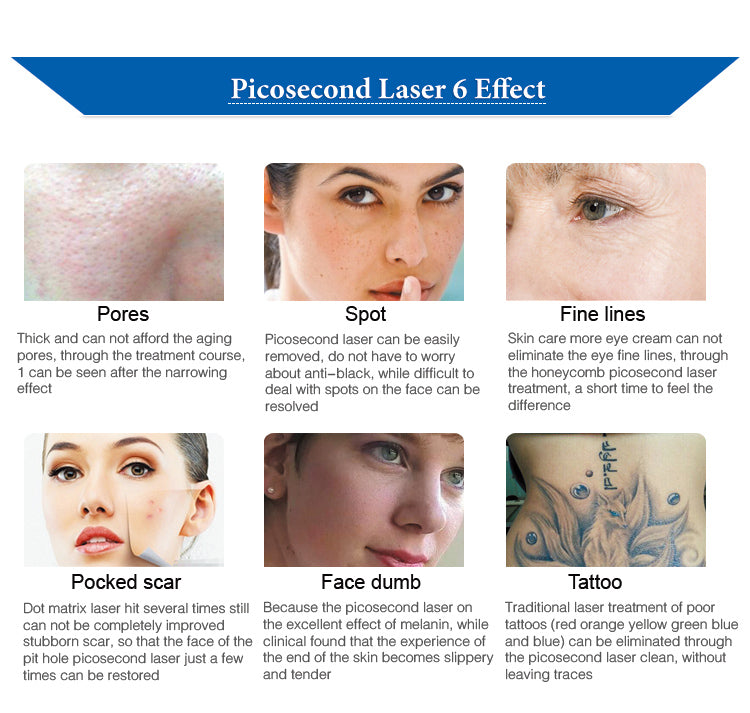 Black Vertical Picosecond Laser Tattoo Removal Pigmentation Therapy Device