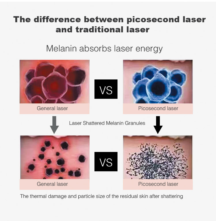 Black Vertical Picosecond Laser Tattoo Removal Pigmentation Therapy Device