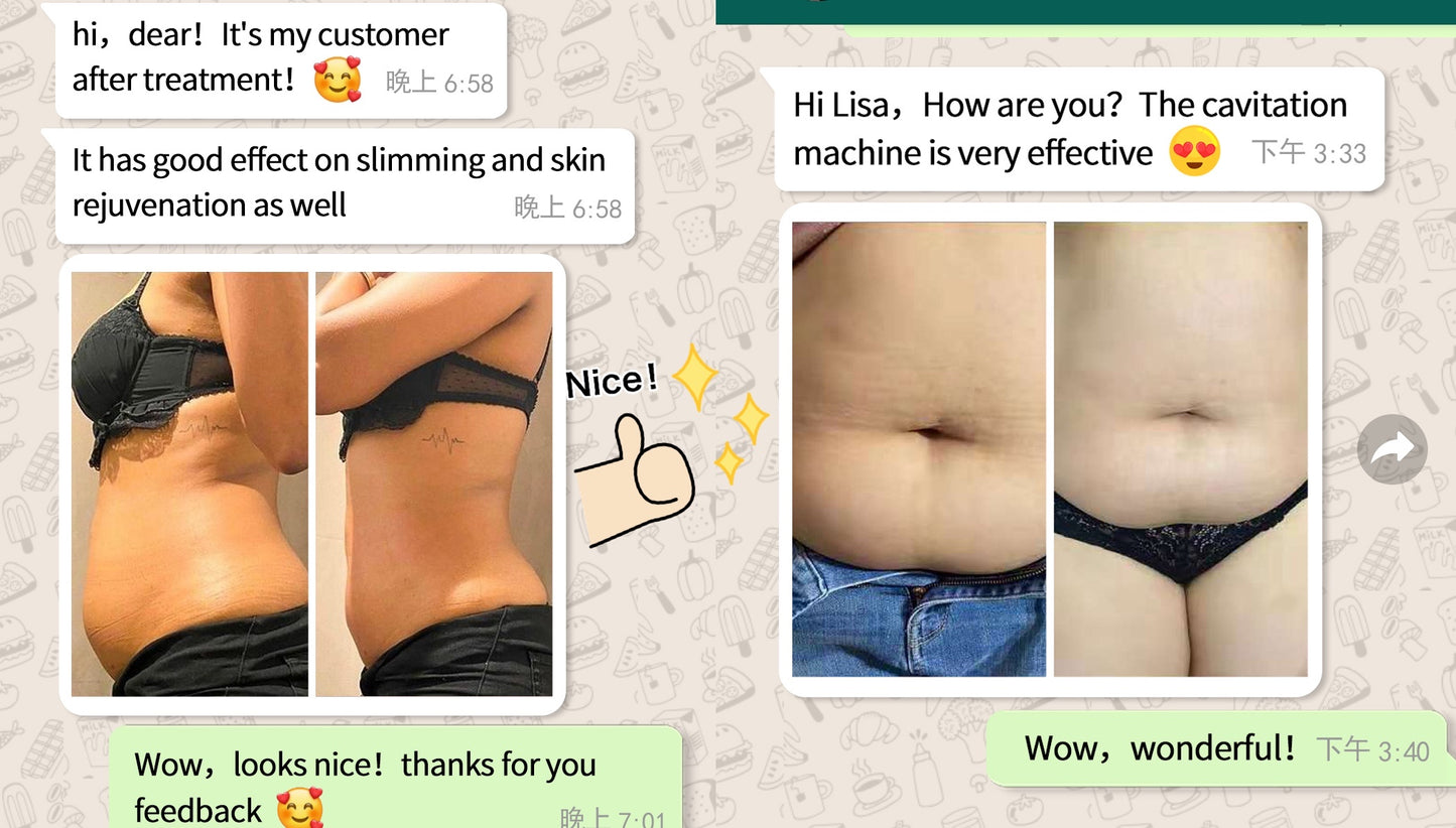 40k Cavitation Ultrasound RF lifting Slimming Machine
