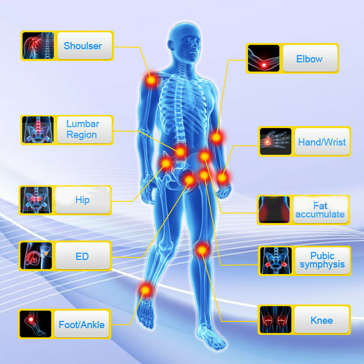 Eswt Shockwave Device Magnetic Physiotherapy Equipment Therapy Machine