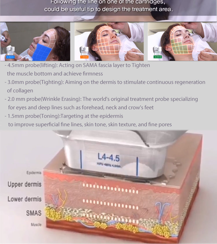 Vertical 7D HIFU Facial Lifting Device With 7 Cartridges