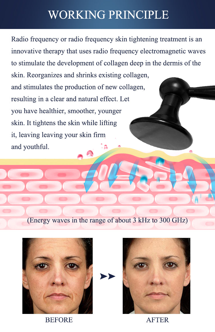 Radio Frequency Facial Photon Skin Care Device Face Lifting Tighten Wrinkle Removal Eye Care RF Skin Tightening Machine