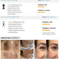 Hydro Dermabrasion Machine High Frequency Ultrasonic Galvanic Facial Scrub Multifunction Spa Facial Massager