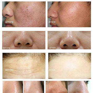 10 in 1 Multifunction Skin Peeling Facial Care Machine Face Lift Skin Tightening Treatment Spa Beauty Machine