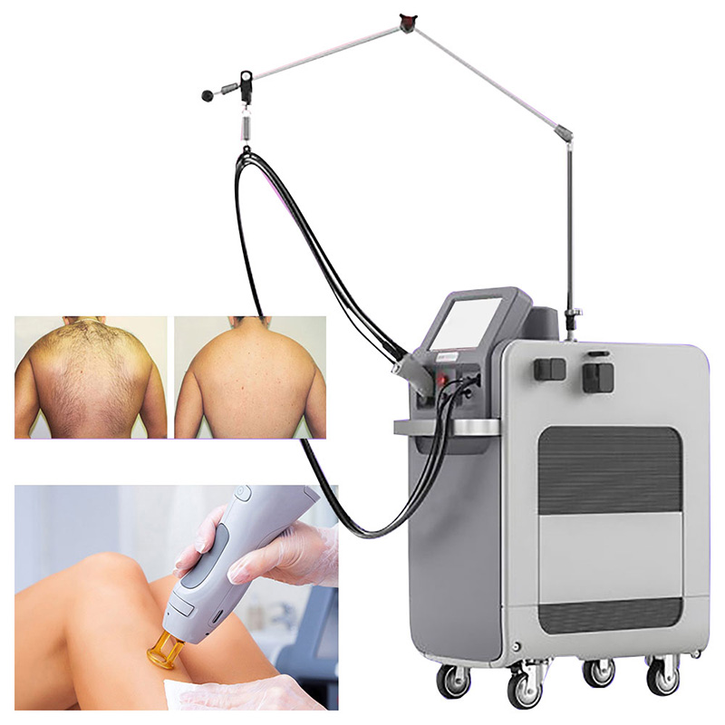 755nm 1064nm Alexandrite Hair Removal Machine