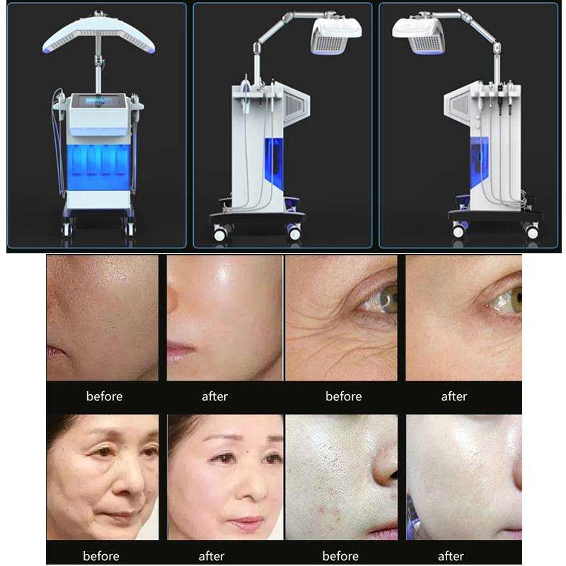 Multifunction Led Light 8 In 1 Hydra Dermabrasion Oxygen Jet Skin Rejuvenation Machine