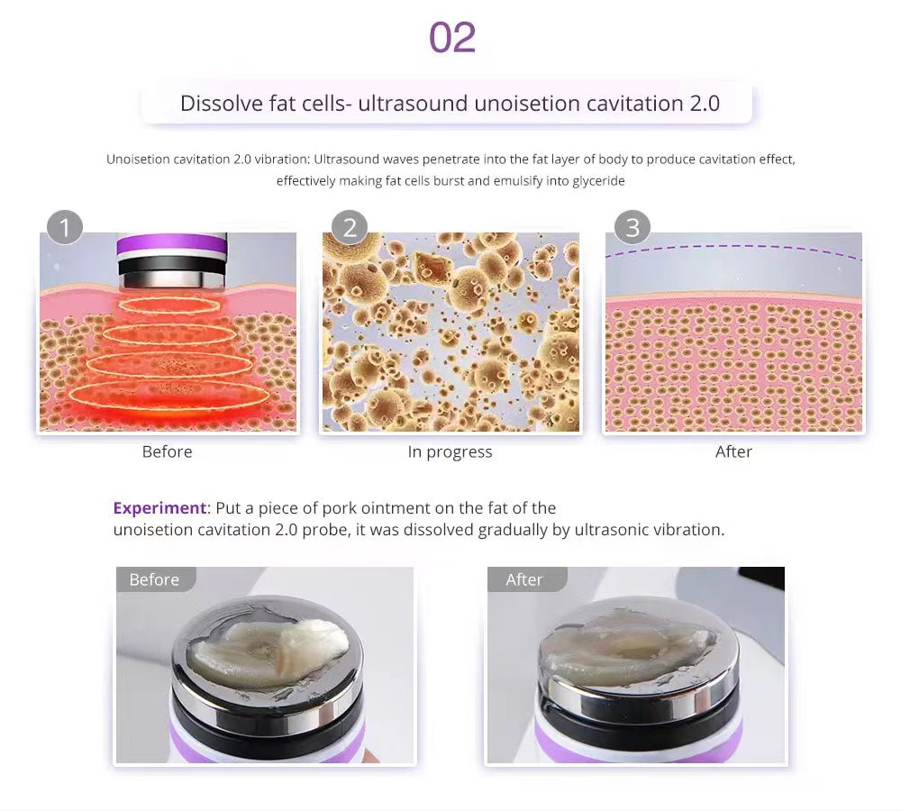 Factory price 8 IN 1 Lipolaser Rf Ultrasonic 40K Vacuum Cavitation System Slimming Beauty Machine