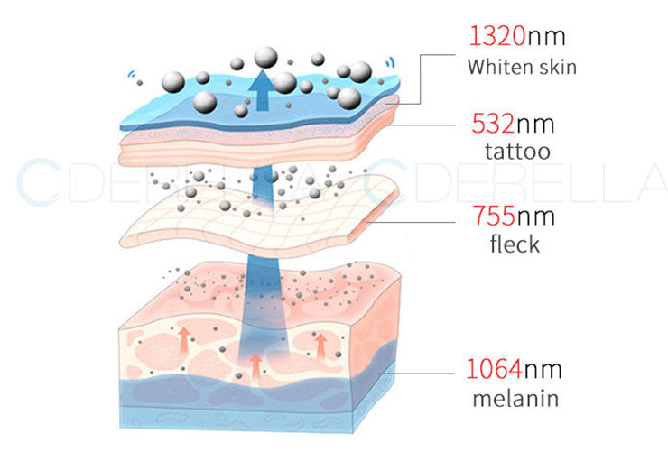 Vertical Picosecond Laser Tattoo Removal Pigmentation Therapy Device