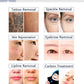 Non-Invasive Picosecond Laser Tattoo Removal  Machine