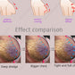 Butt Lifting And Enlargement Vacuum Therapy Machine