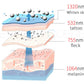 Portable picosecond laser tattoo pigment removal
