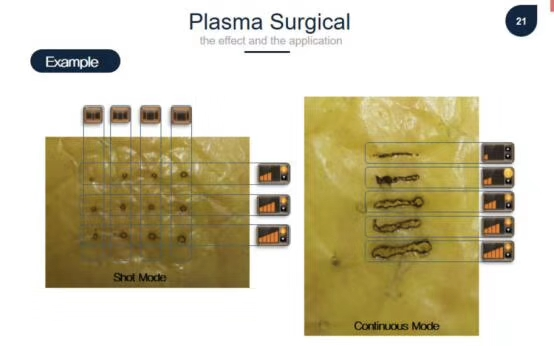 Plasma skin rejuvenation medical facial lifting beauty machine