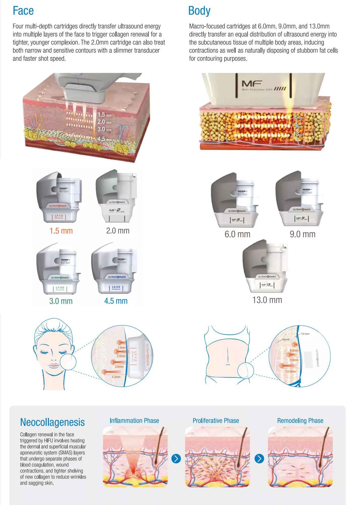 2 In 1 7D HIFU Facial Lifting Device With 10 Cartridges