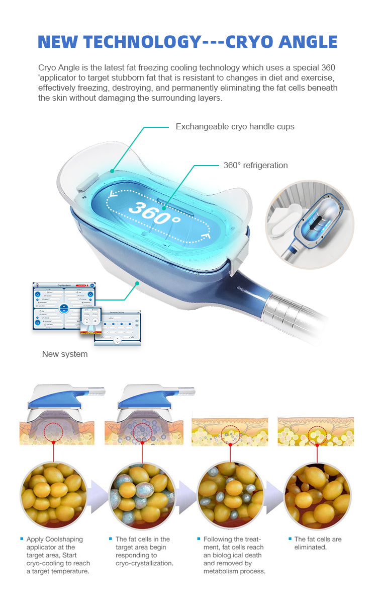 Portable 360 degree cryolipolysis fat freezing body slimming machine