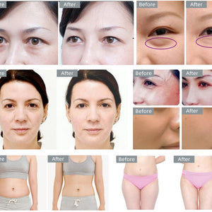 8 in 1 40k Ultrasound Cavitation Body Sculpting machine
