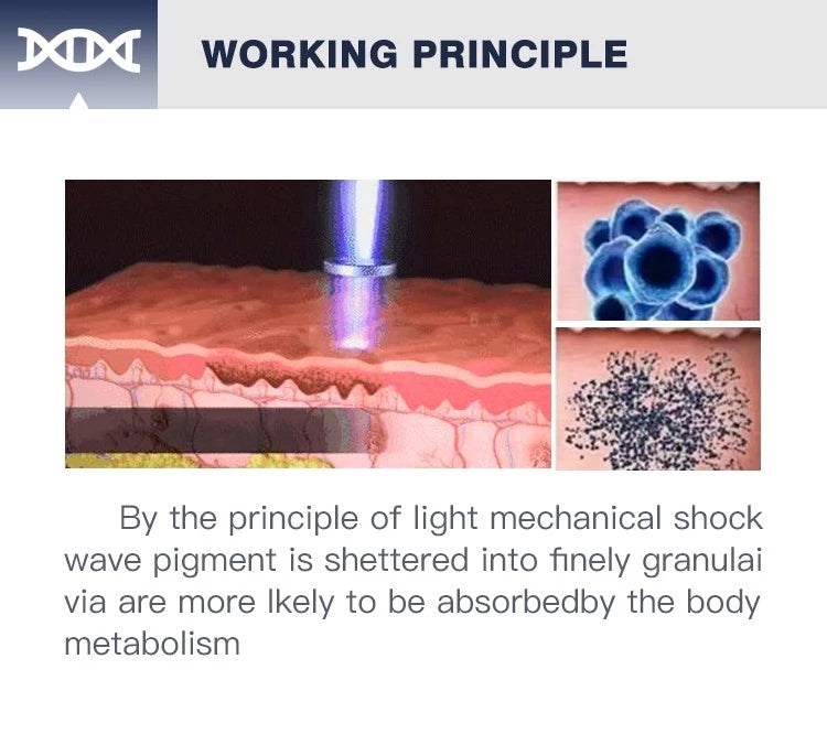 Portable picosecond laser tattoo pigment removal