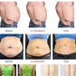 4 In 1 Body Contouring Skin Rejuvenation Effective Weight Loss Beauty Equipment