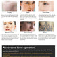 Portable Vertical Picosecond Laser Tattoo Removal Pigmentation Therapy Device