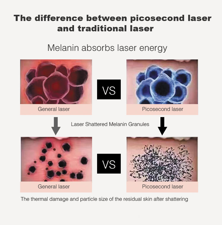 Portable picosecond laser tattoo pigment removal