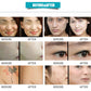 Professional  painless OPT IPL Vertical Hair Removal Machine