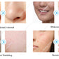 Multifunction Ultrasonic Hydrating Facial Microdermabrasion Machine Skin Care Machine