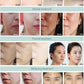 Multifunctional 14 in1 Professional  Hydrafacial Beauty Machine SPA