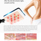 7 in 1 40k Ultrasound Cavitation Fat Reduction  Equipment