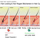 Laser pdt light therapy/anti-hair loss and skin rejuvenation machine