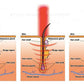Laser pdt light therapy/anti-hair loss and skin rejuvenation machine