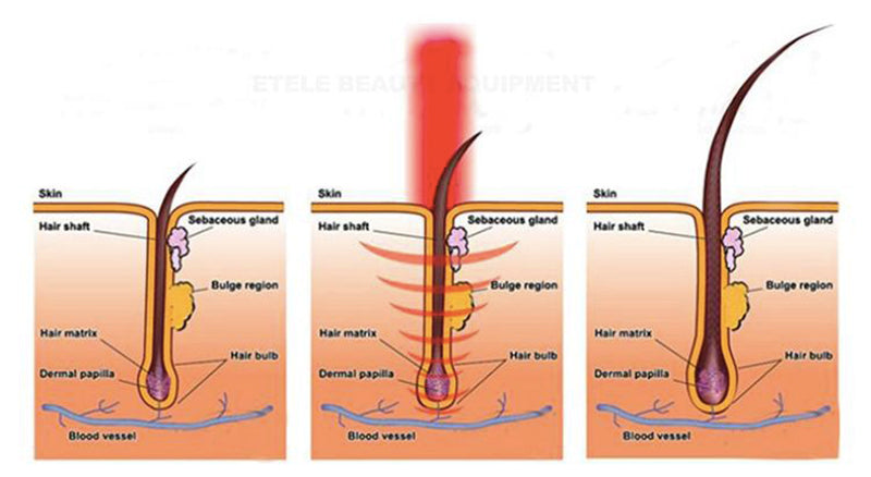 Laser pdt light therapy/anti-hair loss and skin rejuvenation machine