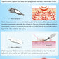 10 in 1 Ultrasonic Hydrating Facial Microdermabrasion Machine Skin Care Machine